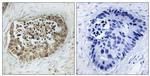 Phospho-SMC1 (Ser966) Antibody in Immunohistochemistry (Paraffin) (IHC (P))