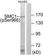 Phospho-SMC1 (Ser966) Antibody in Western Blot (WB)