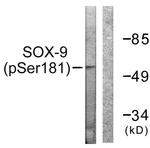 Phospho-SOX9 (Ser181) Antibody in Western Blot (WB)