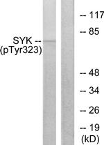 Phospho-Syk (Tyr323) Antibody in Western Blot (WB)