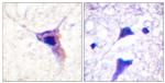 Phospho-Synapsin 1 (Ser62) Antibody in Immunohistochemistry (Paraffin) (IHC (P))