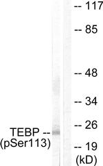 Phospho-p23 (Ser113) Antibody in Western Blot (WB)