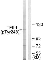 Phospho-GTF2I (Tyr248) Antibody in Western Blot (WB)