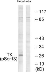 Phospho-TK1 (Ser13) Antibody in Western Blot (WB)