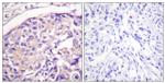 Phospho-TSC2 (Thr1462) Antibody in Immunohistochemistry (Paraffin) (IHC (P))