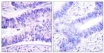 Phospho-WAVE1 (Tyr125) Antibody in Immunohistochemistry (Paraffin) (IHC (P))