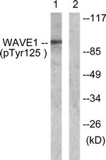 Phospho-WAVE1 (Tyr125) Antibody in Western Blot (WB)