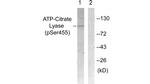 Phospho-ATP Citrate Lyase (Ser455) Antibody in Western Blot (WB)