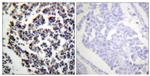 Phospho-BLNK (Tyr96) Antibody in Immunohistochemistry (Paraffin) (IHC (P))