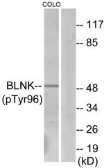 Phospho-BLNK (Tyr96) Antibody in Western Blot (WB)