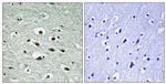 Phospho-CHK1 (Ser296) Antibody in Immunohistochemistry (Paraffin) (IHC (P))