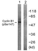 Phospho-Cyclin B1 (Ser147) Antibody in Western Blot (WB)