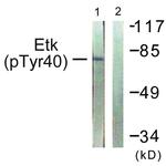 Phospho-ETK (Tyr40) Antibody in Western Blot (WB)