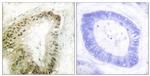 Phospho-LKB1 (Ser428) Antibody in Immunohistochemistry (Paraffin) (IHC (P))