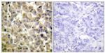 Phospho-MSK1 (Ser360) Antibody in Immunohistochemistry (Paraffin) (IHC (P))