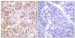 Phospho-MST1/MST2 (Thr183) Antibody in Immunohistochemistry (Paraffin) (IHC (P))