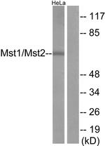 MST1/MST2 Antibody in Western Blot (WB)