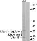 Phospho-MRLC2 (Ser18) Antibody in Western Blot (WB)