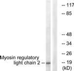MRLC2 Antibody in Western Blot (WB)