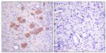 Phospho-NCF4 (Thr154) Antibody in Immunohistochemistry (Paraffin) (IHC (P))