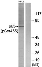 Phospho-p63 (Ser455) Antibody in Western Blot (WB)