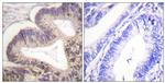 Phospho-PAK2 (Ser20) Antibody in Immunohistochemistry (Paraffin) (IHC (P))