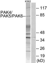 PAK4/6/7 Antibody in Western Blot (WB)