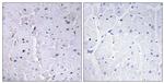 Phospho-PIN1 (Ser16) Antibody in Immunohistochemistry (Paraffin) (IHC (P))