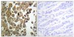 Phospho-PKC delta (Thr505) Antibody in Immunohistochemistry (Paraffin) (IHC (P))