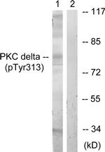 Phospho-PKC delta (Tyr313) Antibody in Western Blot (WB)