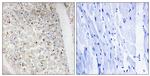 Phospho-PKD1/2/3/PKC mu (Ser738, Ser742) Antibody in Immunohistochemistry (Paraffin) (IHC (P))