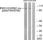 Phospho-PKD1/2/3/PKC mu (Ser738, Ser742) Antibody in Western Blot (WB)