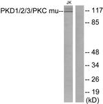 PKD1/2/3/PKC mu Antibody in Western Blot (WB)