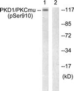 Phospho-PKC mu (Ser910) Antibody in Western Blot (WB)