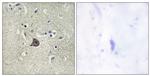 Phospho-PLCB3 (Ser537) Antibody in Immunohistochemistry (Paraffin) (IHC (P))
