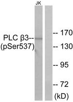 Phospho-PLCB3 (Ser537) Antibody in Western Blot (WB)