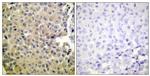 Phospho-PP1 alpha (Thr320) Antibody in Immunohistochemistry (Paraffin) (IHC (P))