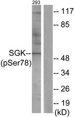 Phospho-SGK1 (Ser78) Antibody in Western Blot (WB)