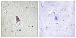 Phospho-TEK (Tyr1102) Polyclonal Antibody