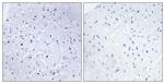 Phospho-53BP1 (Ser6) Antibody in Immunohistochemistry (Paraffin) (IHC (P))