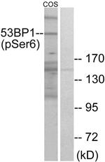 Phospho-53BP1 (Ser6) Antibody in Western Blot (WB)