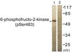 Phospho-PFKFB2 (Ser483) Antibody in Western Blot (WB)