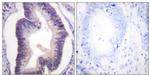 PFKFB2 Antibody in Immunohistochemistry (Paraffin) (IHC (P))