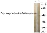 PFKFB2 Antibody in Western Blot (WB)
