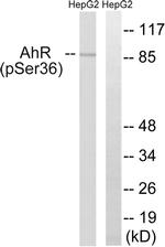 Phospho-AHR (Ser36) Antibody in Western Blot (WB)