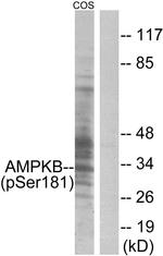 Phospho-AMPK beta-1 (Ser181) Antibody in Western Blot (WB)