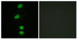 Phospho-Androgen Receptor (Ser94) Antibody in Immunocytochemistry (ICC/IF)