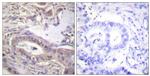 Phospho-Bcl-X (Thr47) Antibody in Immunohistochemistry (Paraffin) (IHC (P))