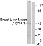 Phospho-BRK (Tyr447) Antibody in Western Blot (WB)