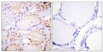 Phospho-ETK (Tyr566) Antibody in Immunohistochemistry (Paraffin) (IHC (P))